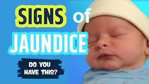 NEWBORN JAUNDICE CAUSES, SYMPTOMS, SAFE REMEDIES AND TREATMENT |JAUNDICE IN NEWBORN | INFANT HEALTH