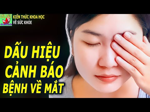 Video: 3 cách chuẩn bị cho khám mắt