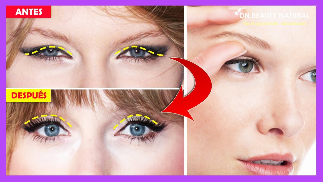 Ejercicios de eliminación de grasa de párpados para agrandar los ojos y arreglar los párpados Ejercicios de eliminación de grasa de párpados para agrandar los ojos y arreglar los párpados