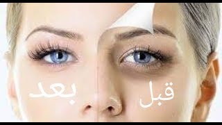 كيفيه التخلص من السواد تحت العين | 5 طرق سهله وبسيطه .