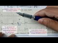 Normal sinus rhythm ecg   