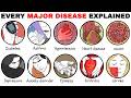 Every Major Disease &amp; Its Effects Explained