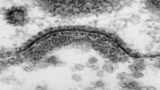 Movie 15.5 Clathrin