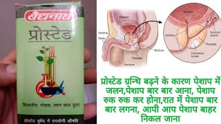 Prostaid Tablet Reviewपशप बर बर लगन,पशप म जलन,पशप रक कर हनपरसटड वदध म उपयग