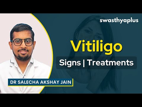 Vitiligo (White Patches on Skin) - Signs, Treatments & Prevention | Dr Salecha Akshay Jain