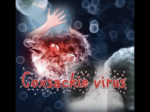 Video: Coxsackie Virusas Vaikams - Simptomai, Gydymas, Profilaktika, Pasekmės