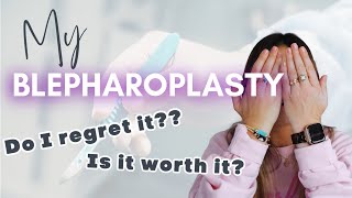 MY BLEPHAROPLASTY STORY ‍⚕ | IS IT WORTH IT? | ANY REGRETS?