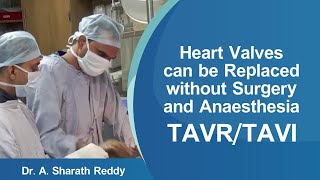 Heart Valves can be Replaced without Surgery and Anaesthesia | TAVI | TAVR | Medicover Hospitals