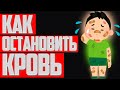 Как остановить кровь | Кровотечение | Капиллярное, Венозное, Артериальное кровотечение | Помощь