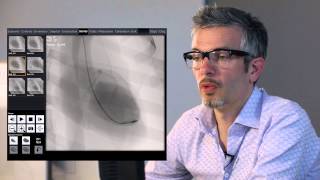 Left Ventricular Ejection Fraction - Mentice VIST-C