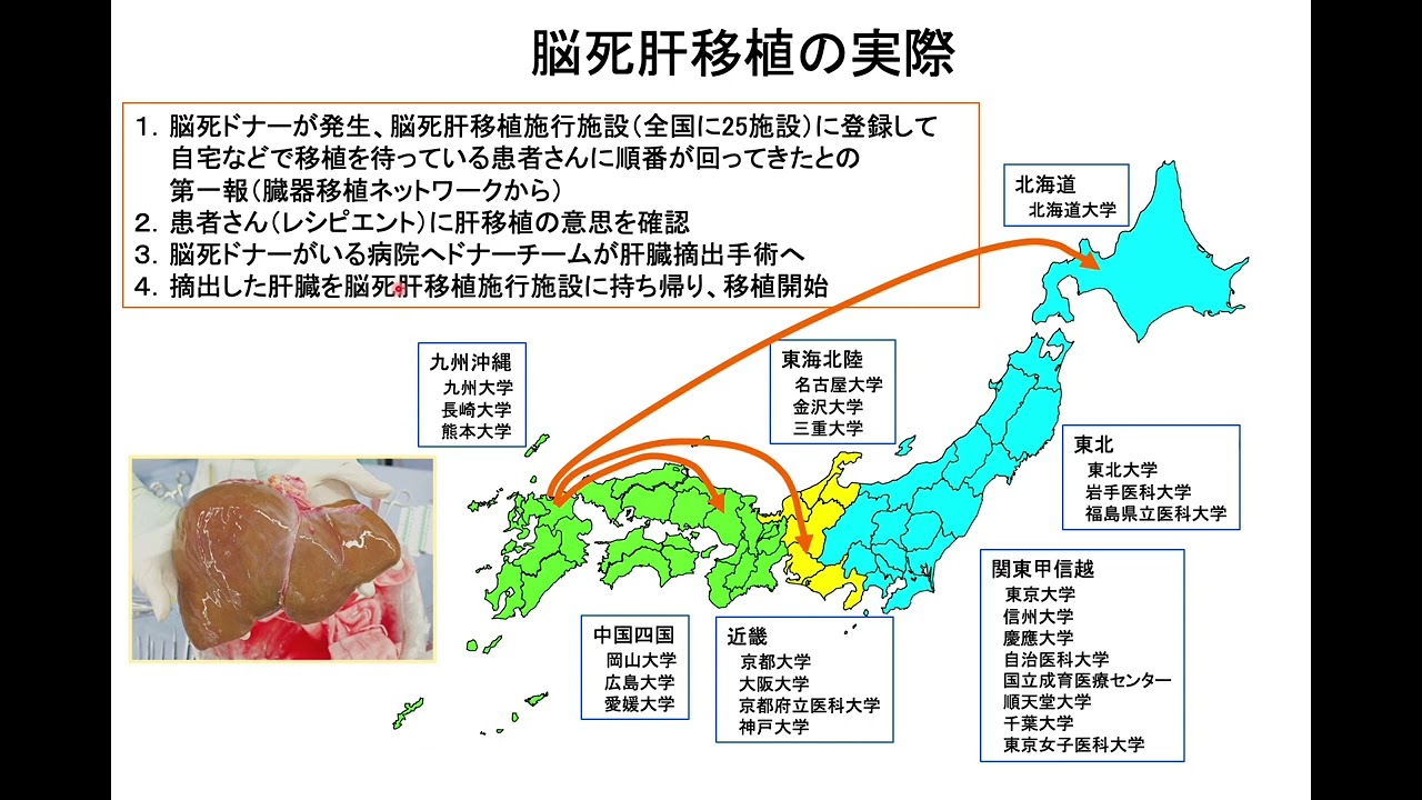 臓器移植動画