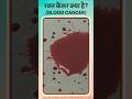 रक्त कैंसर के ये लक्षण अनदेखा मत करें! | Blood Cancer Warning Signs You Should NEVER Ignore!