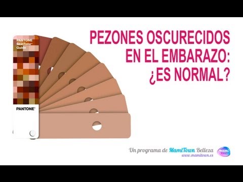 Vídeo: Pezones Oscuros: Causas, Síntomas A Tener En Cuenta Y Más