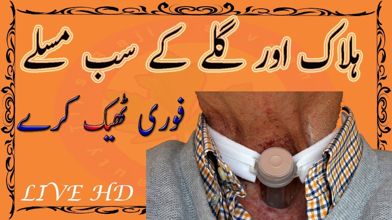 Throat Tonsils Treatment - Tonsillitis Causes Fast And Easy Treatment Free Home Remedy - - YouTube