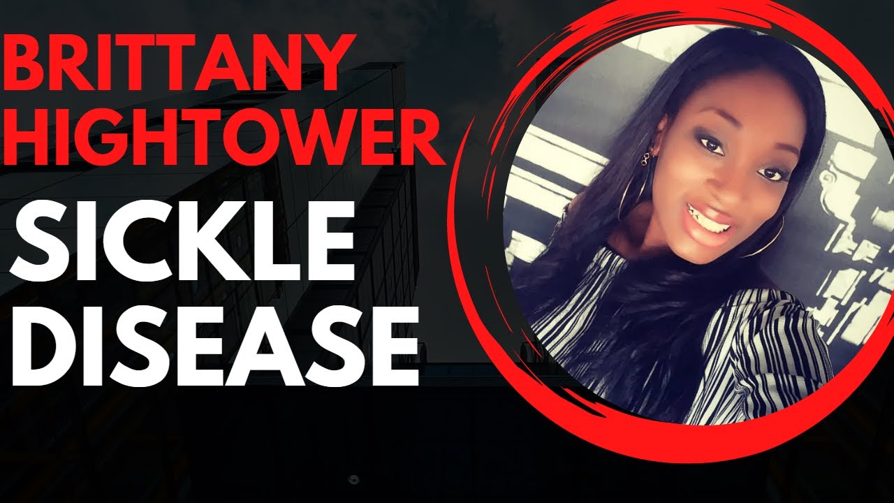 Brittany Hightower Sickle Cell What Happened to Brittany Hightower