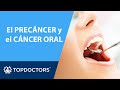 ODONTOLOGÍA: el PRECÁNCER y CÁNCER ORAL🤒 | Top Doctors (3/4)