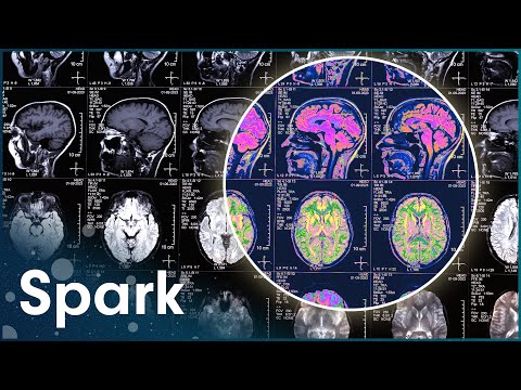 Inside the Experiments Trying to Prove the Existence of Telepathy