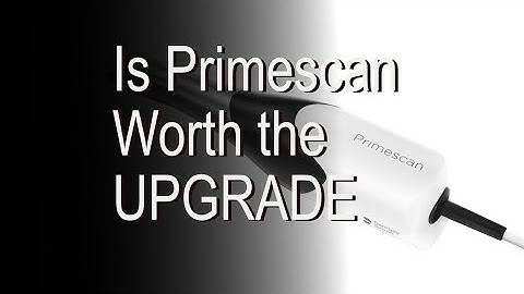 Is Primescan worth the upgrade?
