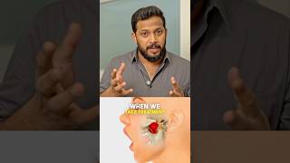 Did You Know? Tmj Issues Can Trigger Migraines