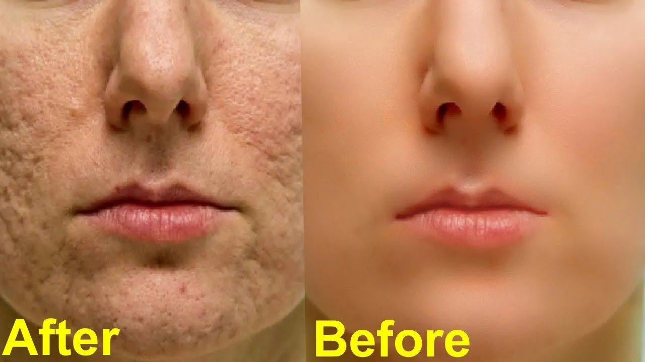 NATIONAL A APPLY KORBO KIVABE visual data 6