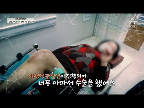 [예고] 무너지는 관절 이대로 보고만 있을 것인가, 연골 속 관절 스프링을 지켜라! | 100세 프로젝트 48 회