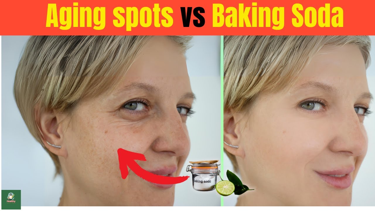 baking-soda-remove-age-spots-on-the-skin-permanently-baking-soda-skin