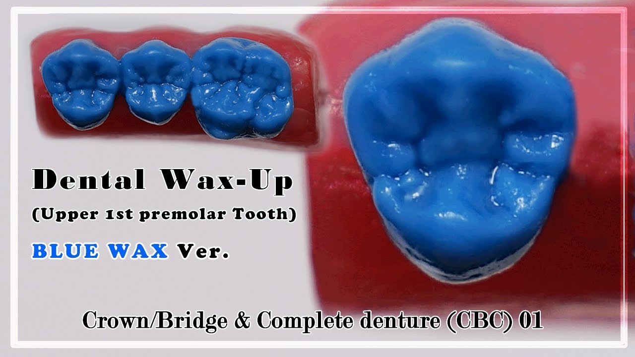 Dental Waxup For Crown/Bridge & Complete denture(CBC) Upper 1st