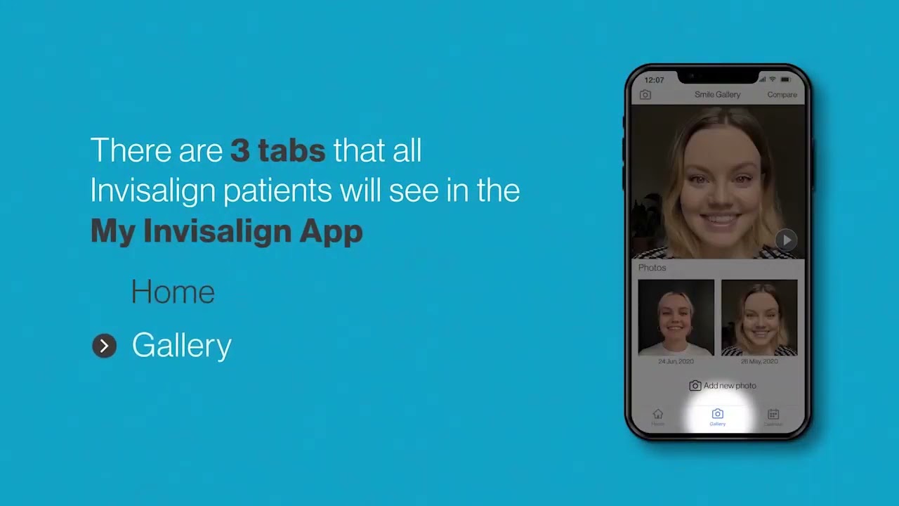 My very first day of Invisalign - Virtual Care - How to download my invisalign app