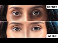 Remove Dark Circles Permanently FAST! | Natural Home Remedies