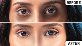 Remove Dark Circles Permanently FAST! | Natural Home Remedies screenshot 5