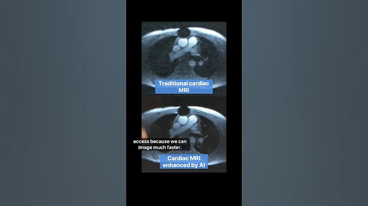 How AI is Changing Medical Imaging