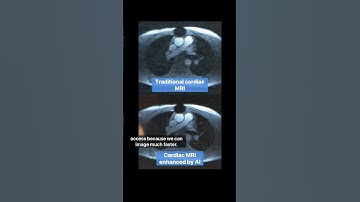 How AI is Changing Medical Imaging