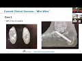 MedShape WEBINAR: The DynaNail Mini® Fusion System