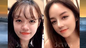 Bác sĩ chia sẻ những điều cần biết khi sửa mũi hỏng