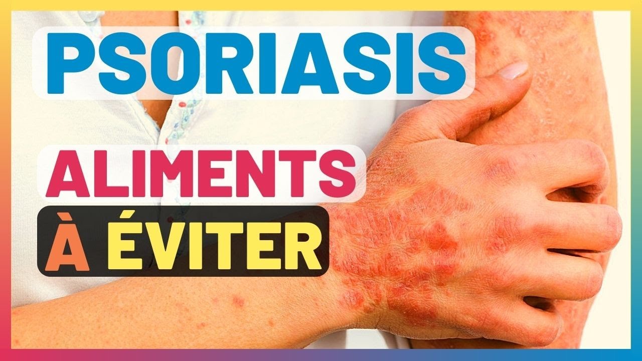 PSORIASIS Quels Aliments pour Limiter ? YouTube — free download