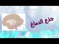 جذع الدماغ نور صفوت جذع الدماغ نور صفوت