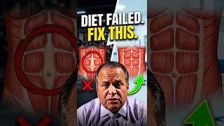 Why diet and exercise won't fix your stomach #tummytuck #diastasisrecti #momlife
