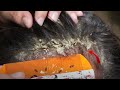 Removed Hundred of Lice From Head and Dry Scalp Huge Dandruff of Flakes Removal With Comb # 1765
