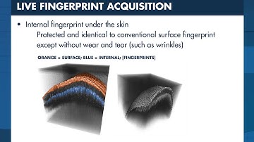Optical coherence tomography