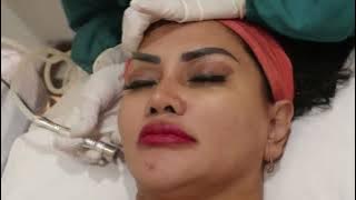 Sisca Mellyana - Combo treatment for glowing skin - Beauty Regime