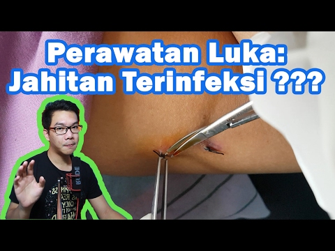 Video: Jahitan Yang Terinfeksi: Gambar, Gejala, Penyebab, Dan Perawatan