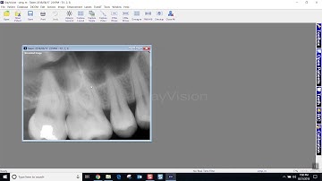 Training: Apteryx XrayVision 4: Moving Images Between Patient Charts