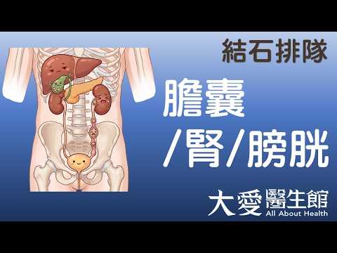 【大愛醫生館】 結石排隊 20261023