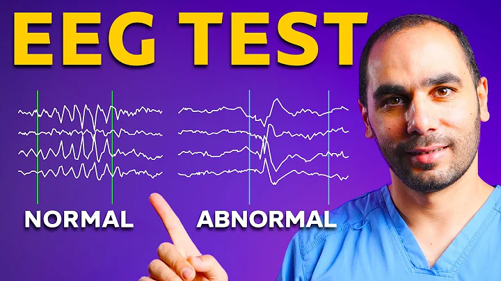 EEG Test: Epilepsy Neurologist Explains