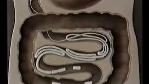 Паразитические плоские черви.  Таблицы и видео