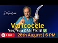 Varicocele 101: The Hidden Male Roadblock You CAN Treat | Dr. Sunil Jindal LIVE