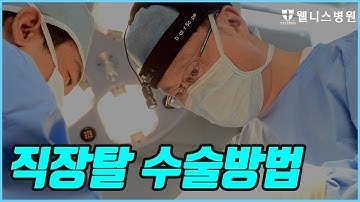 [방송] 직장탈수술방법