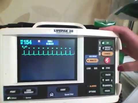 Cardioversion of Atrial Fibrillation