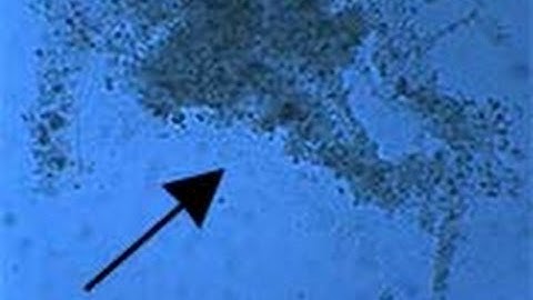 Swarm of bacteria