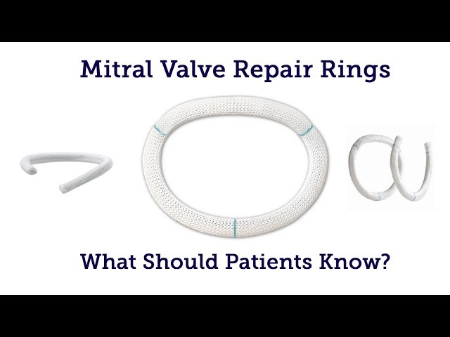 suture valve ring in mitral valve repair operation Stock Photo - Alamy